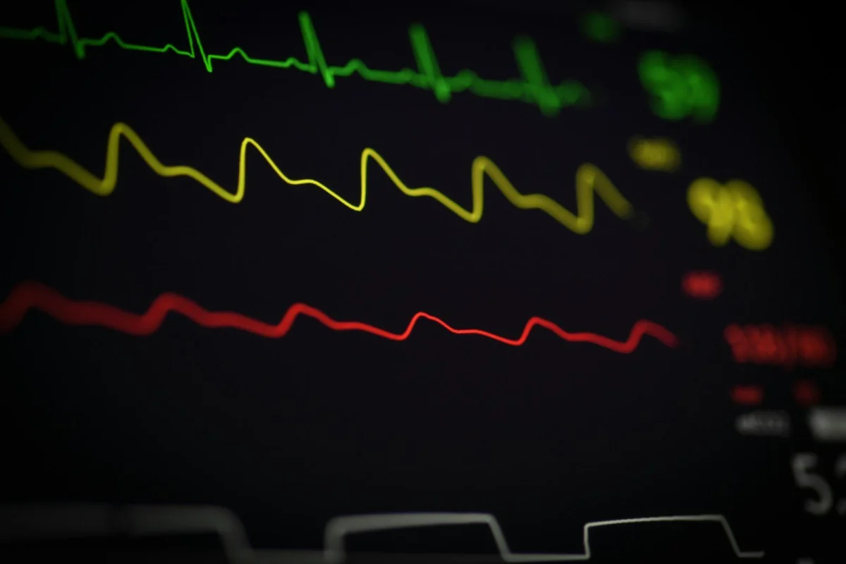 MET Values, RPE, and Heart Rate Zones: How Exercise Scientists Measure Intensity